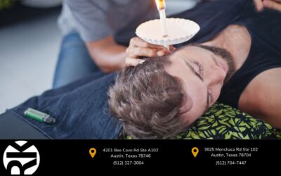 Ear Candles: Are They Safe for Removing Ear Wax?